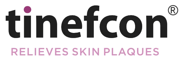 Tinefcon — Globyz Partnership